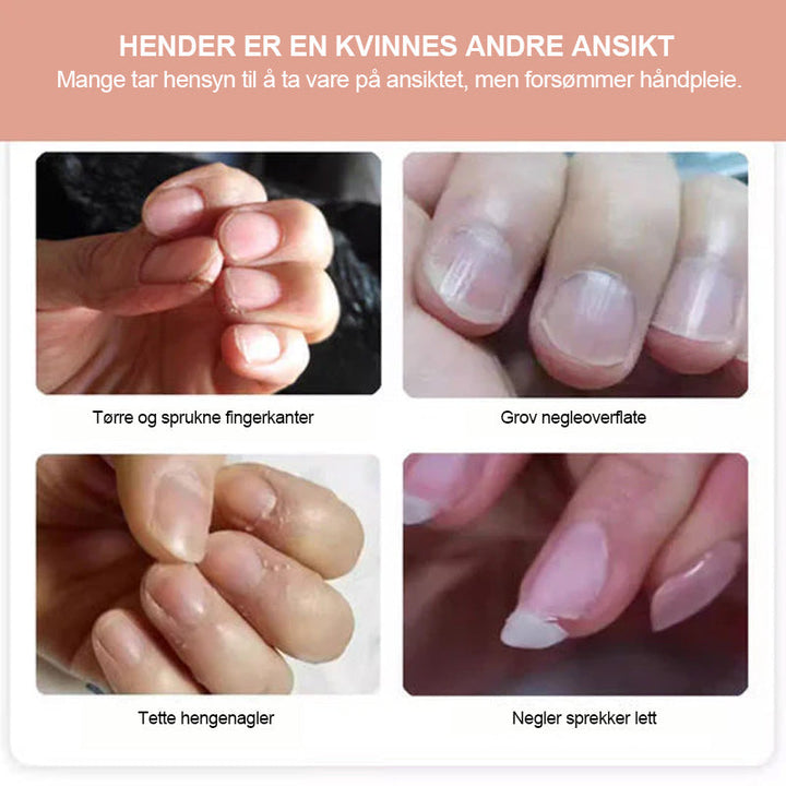 Nærbilde av negleolje med dråpe, for intensiv fuktighet og sunn vekst til negler.