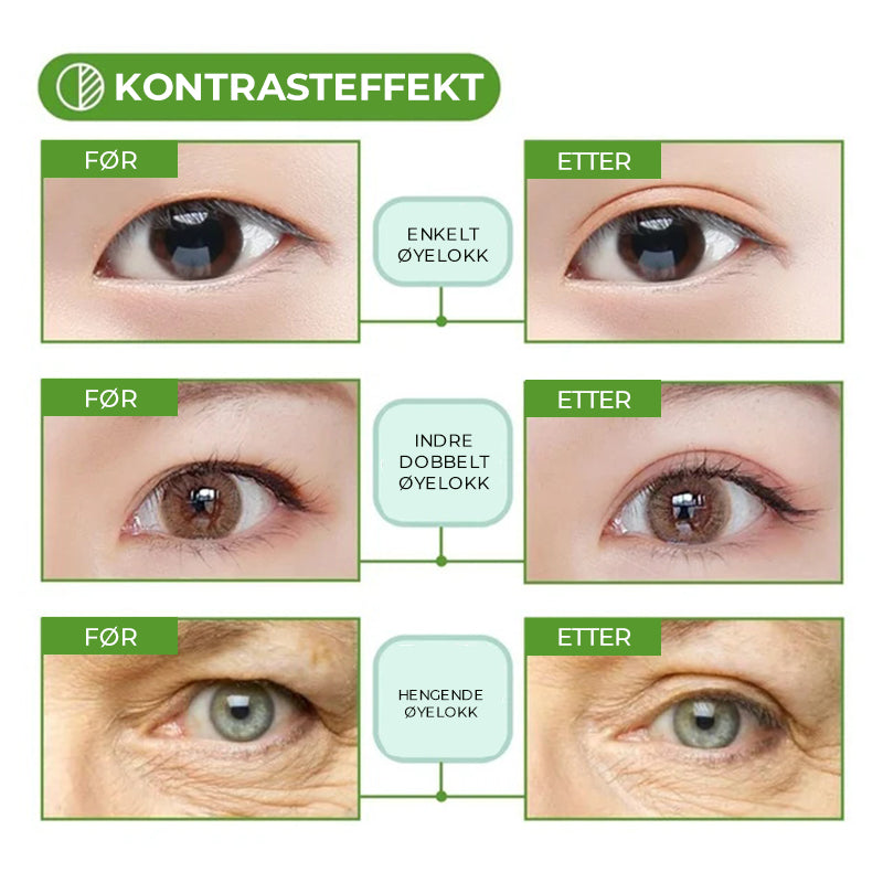 Komfortable og diskré øyelokkstape for et naturlig, langvarig øyeløft og friskere utseende.