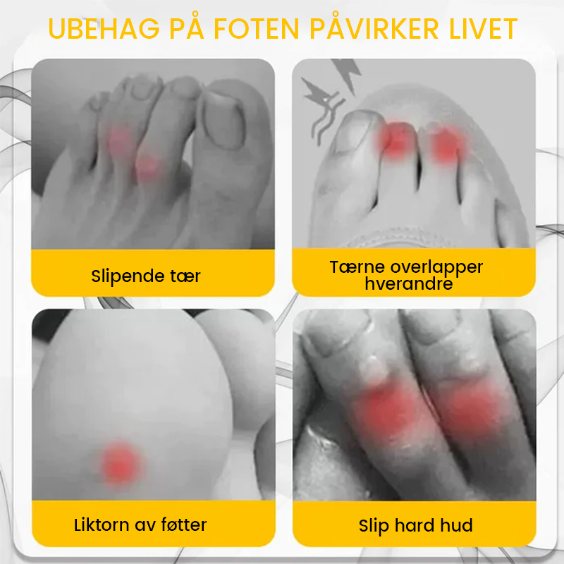 Myke silikon tåbeskyttere spesielt designet for liktorn og gnagsår. Gir effektiv smertelindring.