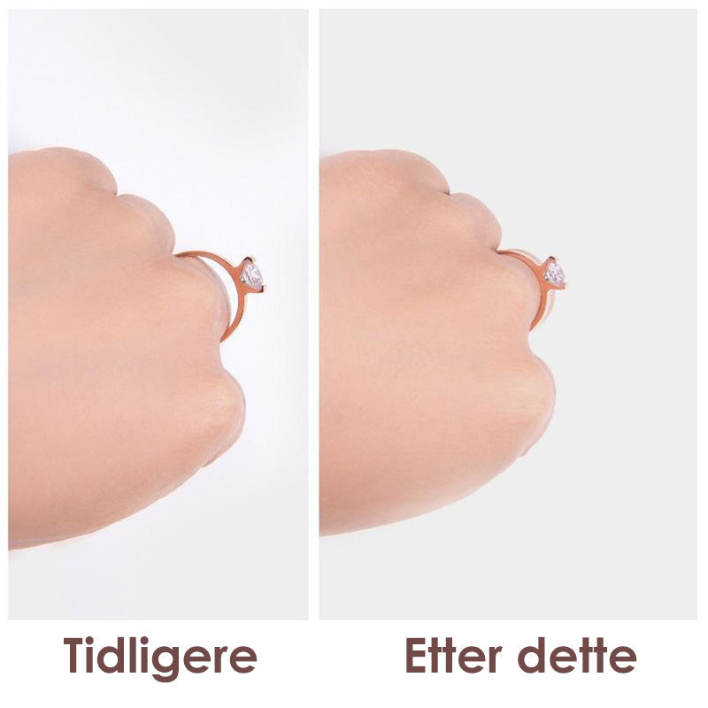 Smykkevedlikehold: Usynlig ringjusterer i TPU forbedrer komfort og forhindrer løse ringer.