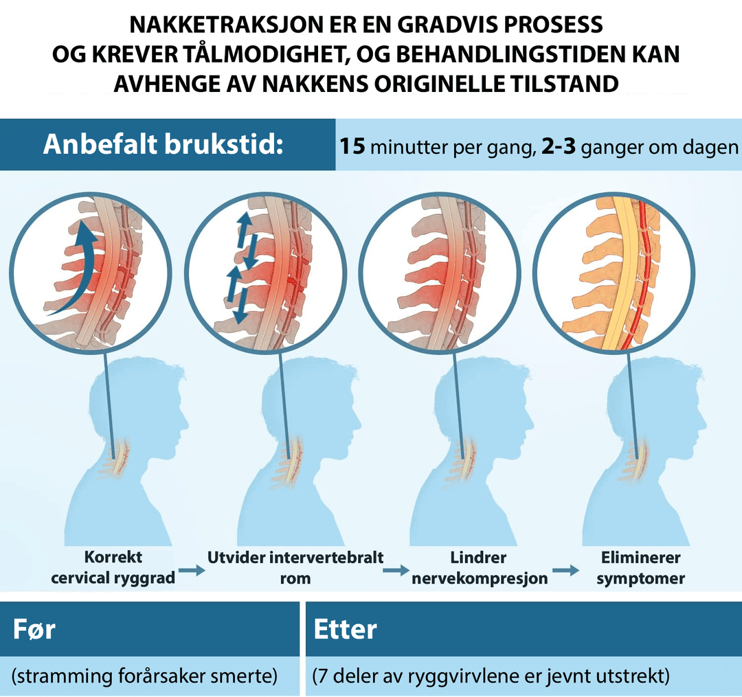 Detalj av justerbar nakkestrekker som gir ergonomisk støtte og spenningslindring for nakke og skuldre.