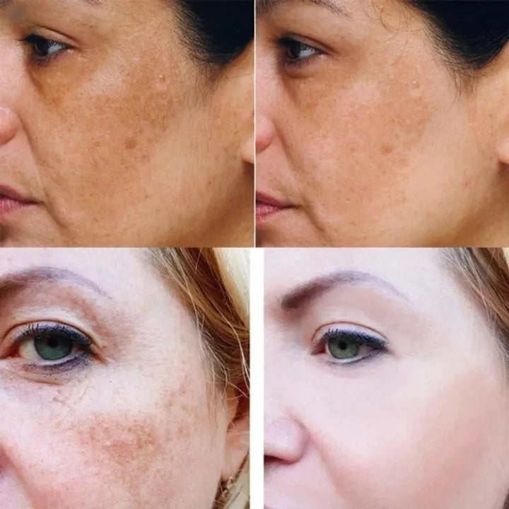 Effektivt gurkemeie serum mot mørke flekker og pigmentering. Forbedrer hudtone og gir en naturlig glød.